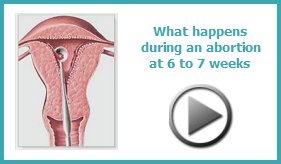 What happens during abortion at 6 to 7 Weeks